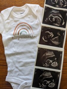 A rainbow onesie and ultrasound pictures of the Mahons' daughter Gracie from April 2023. (Courtesy of Kirsti Mahon)