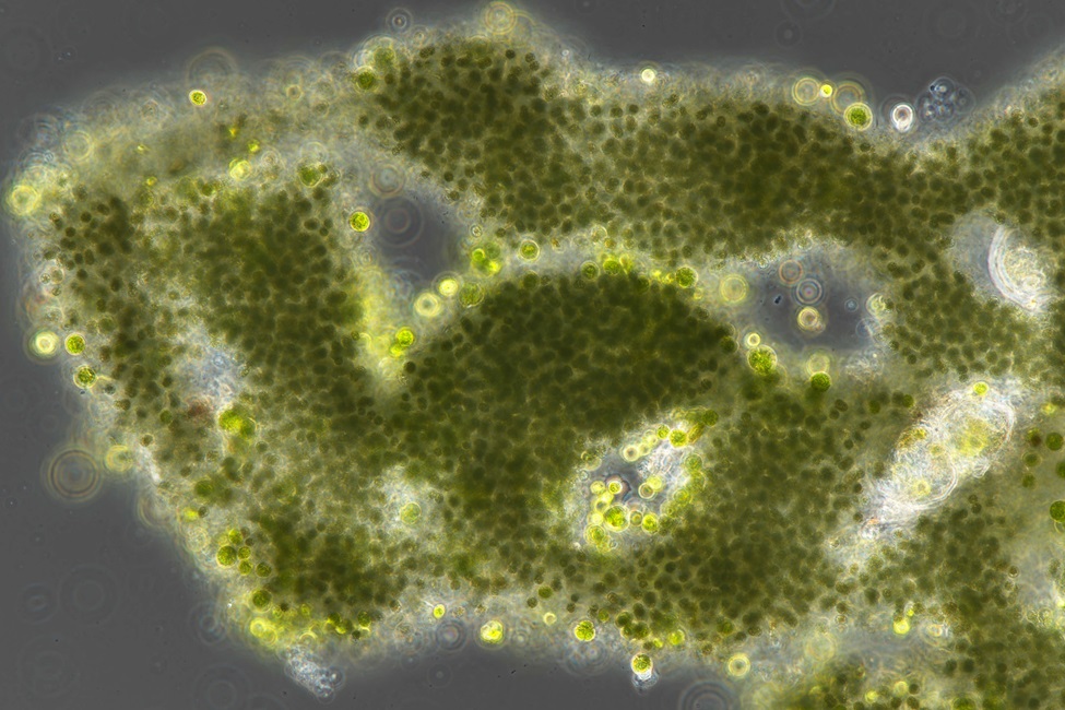 A microscopic view of Microcystis (Photo credit: Malcolm McFarland, Ph.D.)